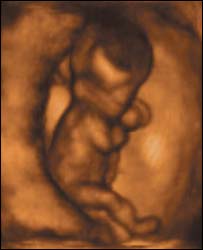 Baby walking in the womb.