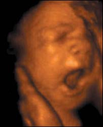 Baby yawning.